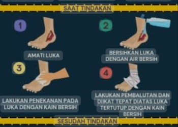 Langkah penting jika anda menjadi korban kecelakaan