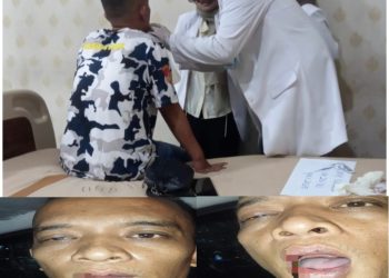 Diduga Dianiaya di Area Gereja, Warga Bandar Lampung Laporkan Mahasiswa Teologi ke Polisi